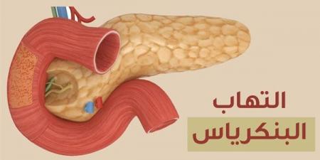 أعراض التهاب البنكرياس، استشاري باطنة يوضح ويحذر من إهمالها