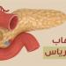 أعراض التهاب البنكرياس، استشاري باطنة يوضح ويحذر من إهمالها